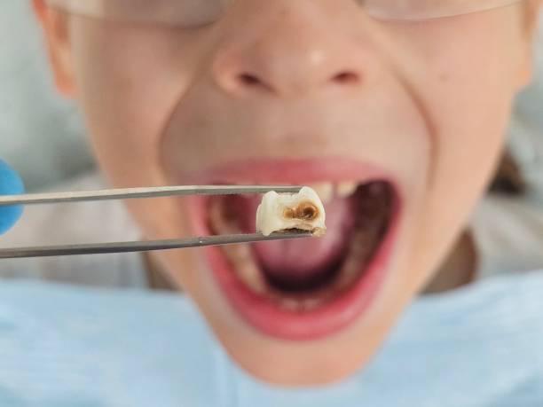 Best Emergency Treatment for Toothache in Jordan, MN